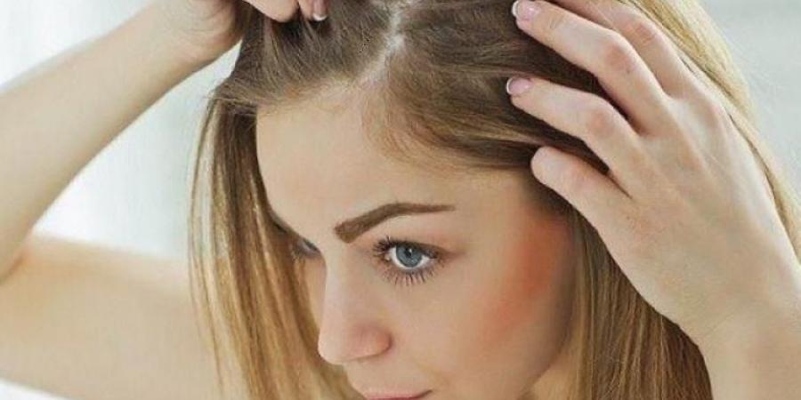 عادات يومية بسيطة للتخلص من قشرة الرأس - ايجي سبورت